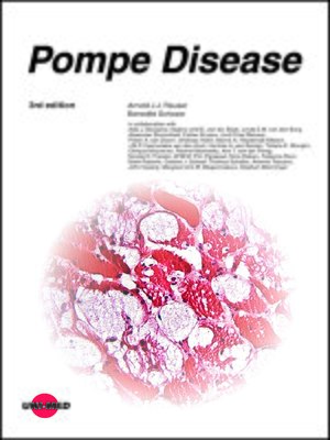 cover image of Pompe Disease
